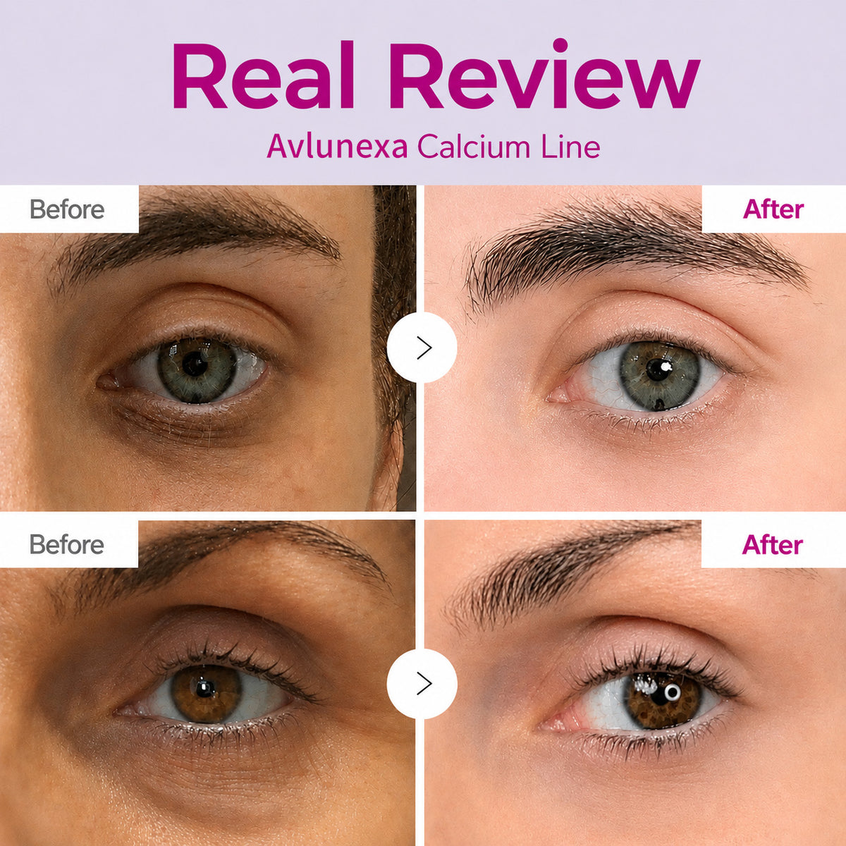 🔥LAST DAY 50% OFF!!Avlunexa Korean Calcium Dark Spot Eye Cream