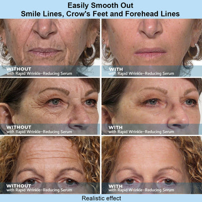 Avlunexa™ Instant Face Temporary Tightener – Instant visible results in 60 seconds