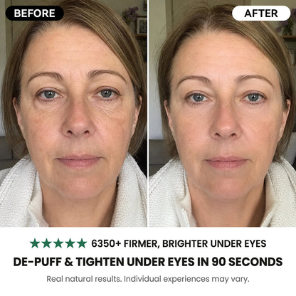 Reverse-Aging Temporary Eye Tightener: Younger Looking Eyes In 90 Seconds